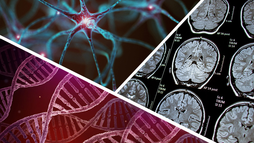 Three biological factors that contribute to Parkinson's disease
