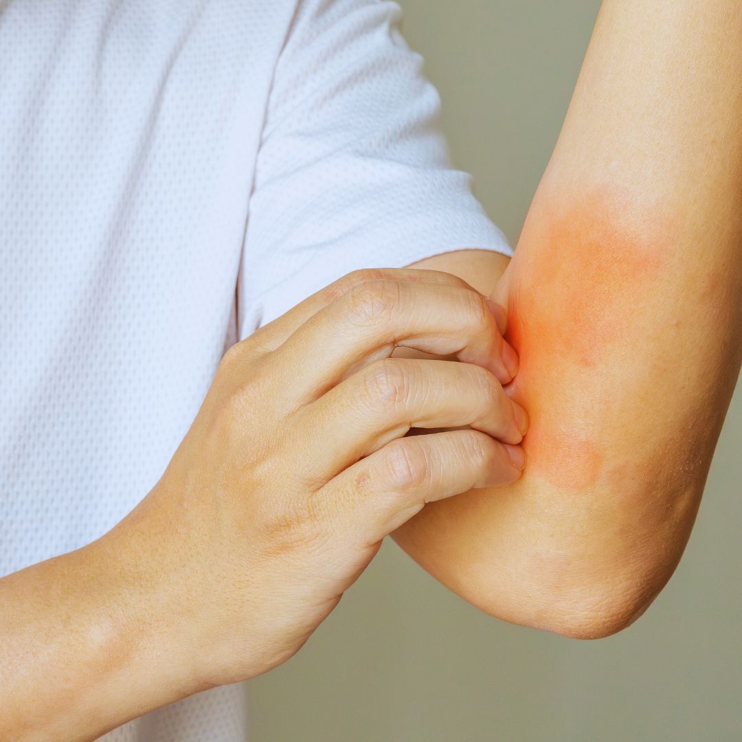 A person itching their arm