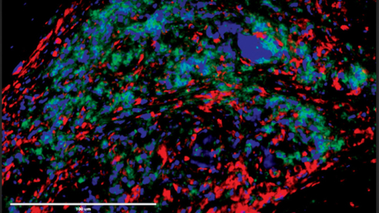 Computer image of immune cells