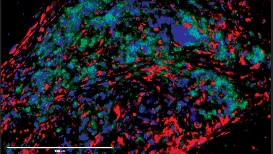 A computer image of immune cells.